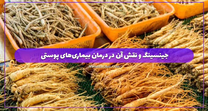 جینسینگ و پسوریازیس